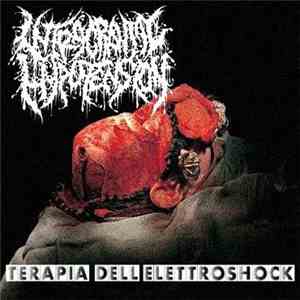 Intracranial Hypotension - Terapia Dell'Elettroshock download free